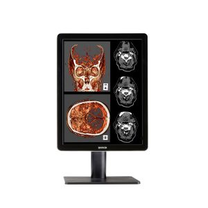 Nio Color 5MP  (MDNC-6121)